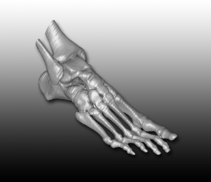 foot Scan 1 copy Medical