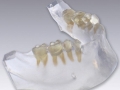3D Printed mandible
