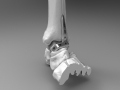 Ankle plate design