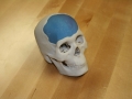 3D Printed skull model with cranial implant prototype